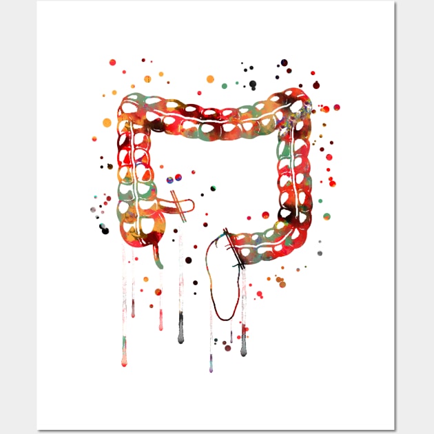 Lower gastrointestinal tract Wall Art by RosaliArt